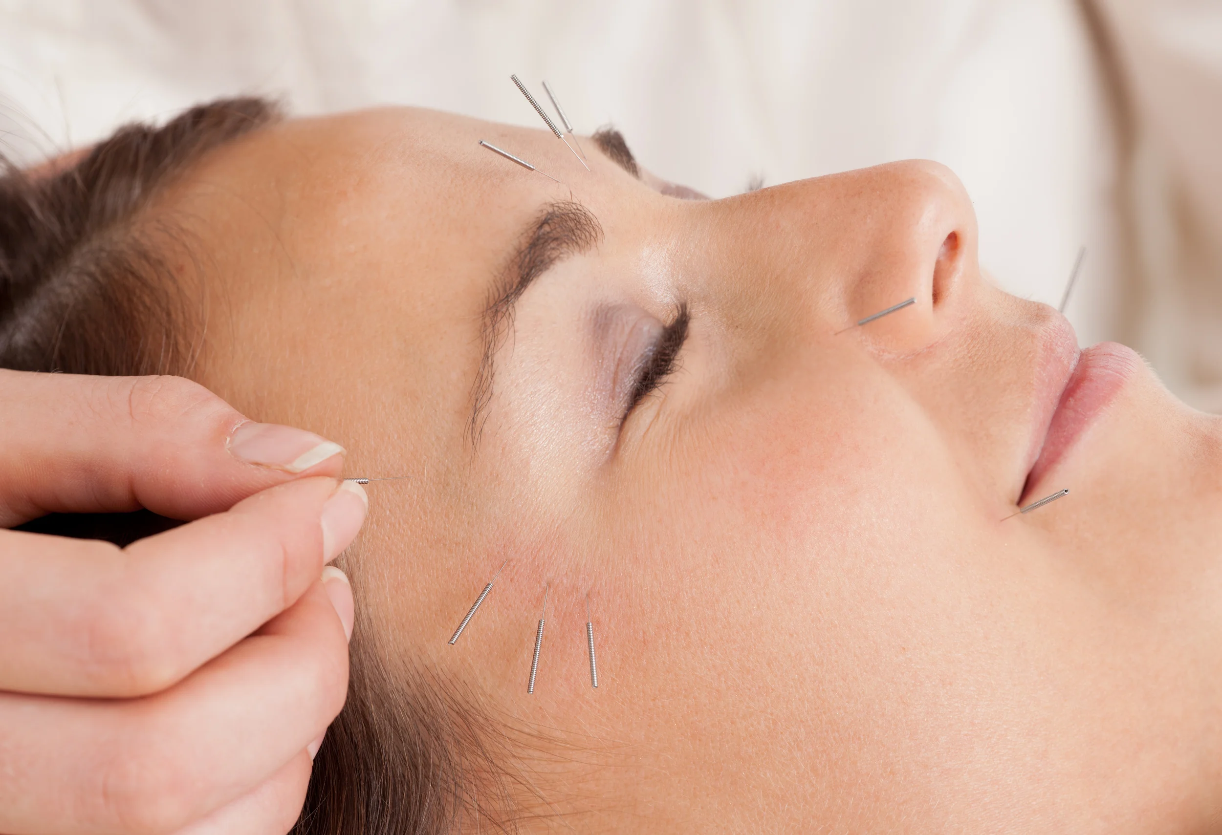 Facial Rejuvenation Cosmetic Acupuncture