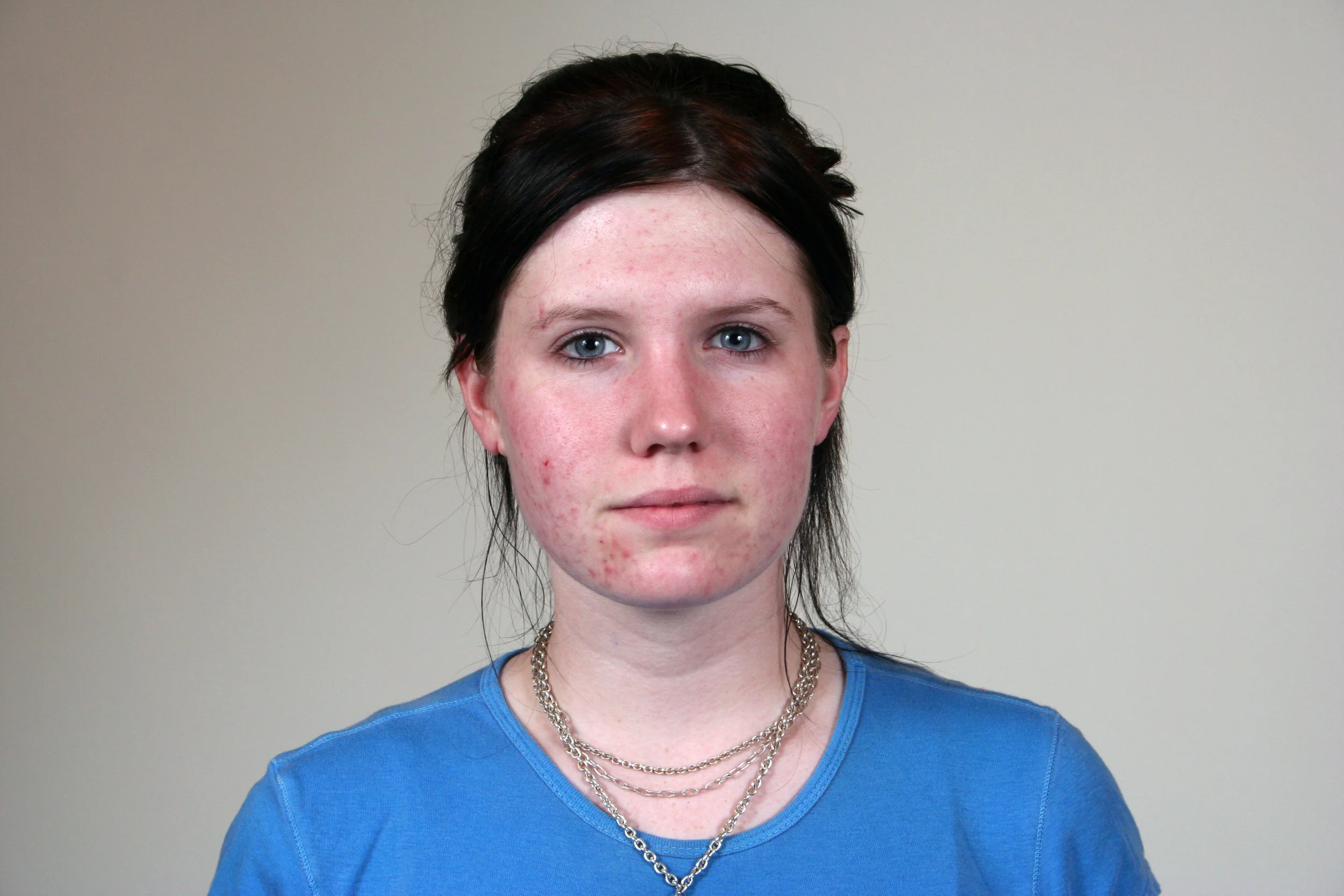 Sammi Before.jpg