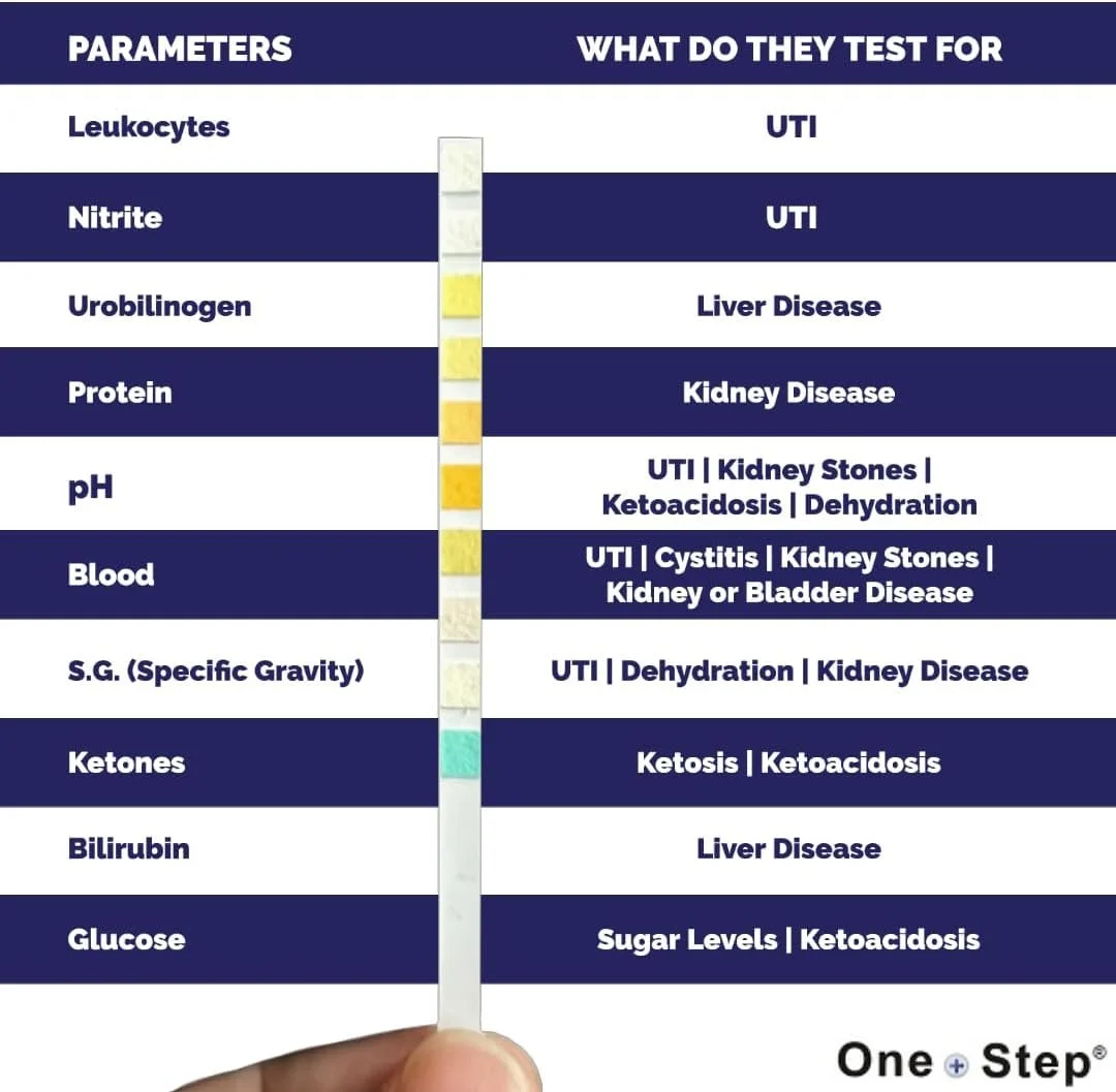 Urine test strip comparison chart displaying parameters with potential health indications.