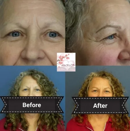 Microblading