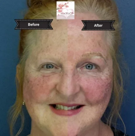 Microblading