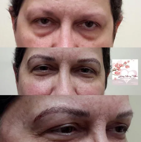 Microblading