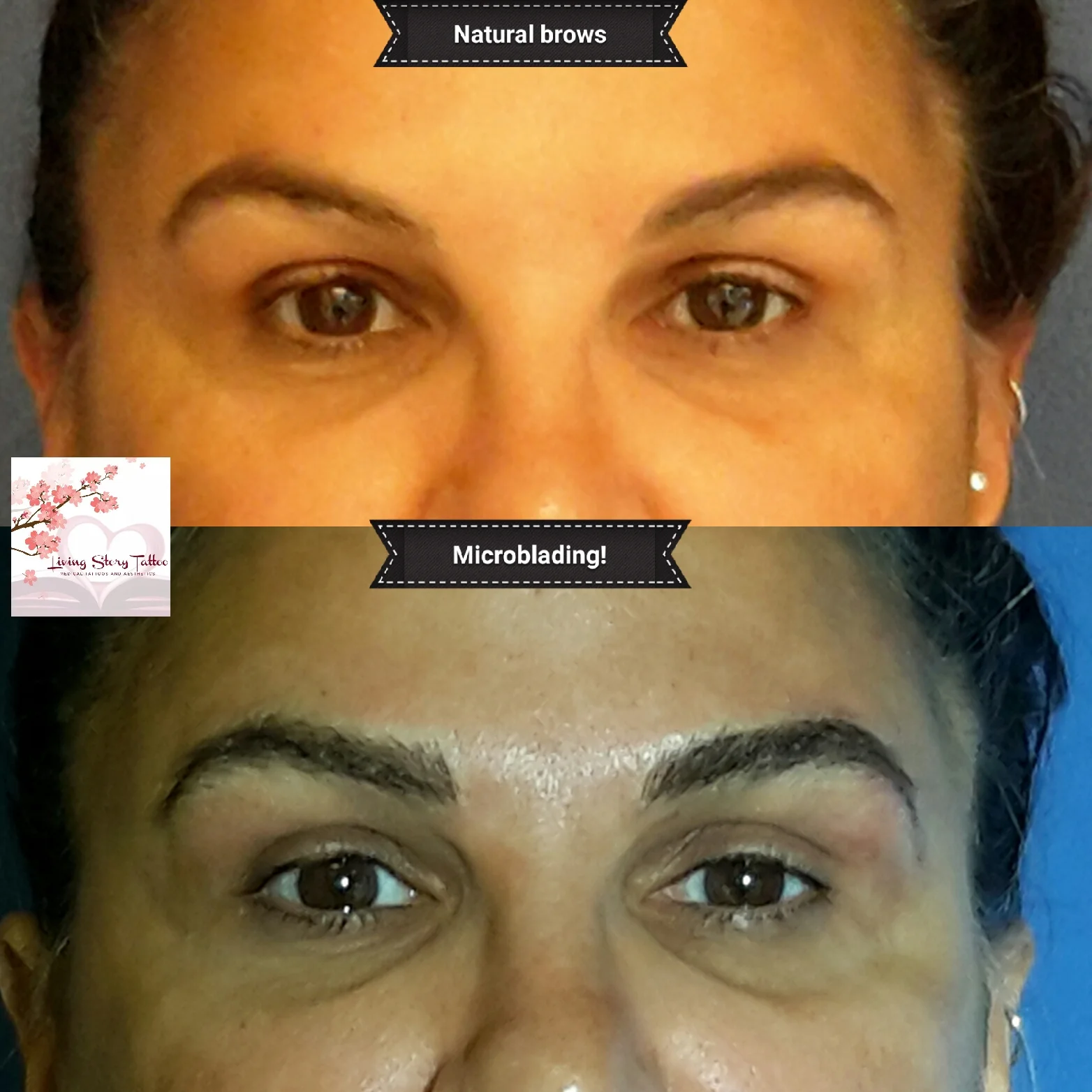 Microblading