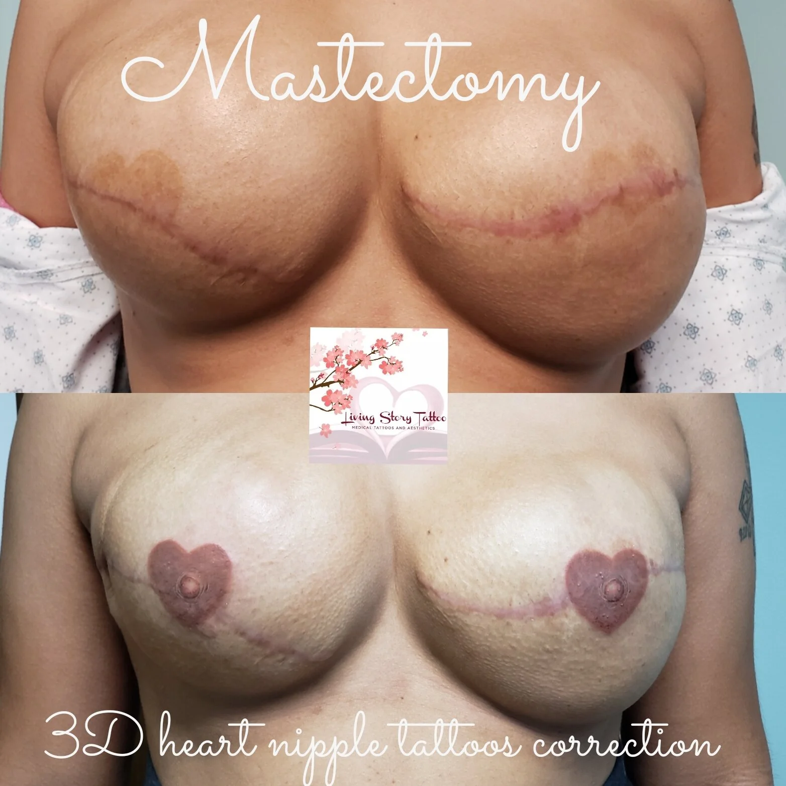 Corrective Heart tattoos