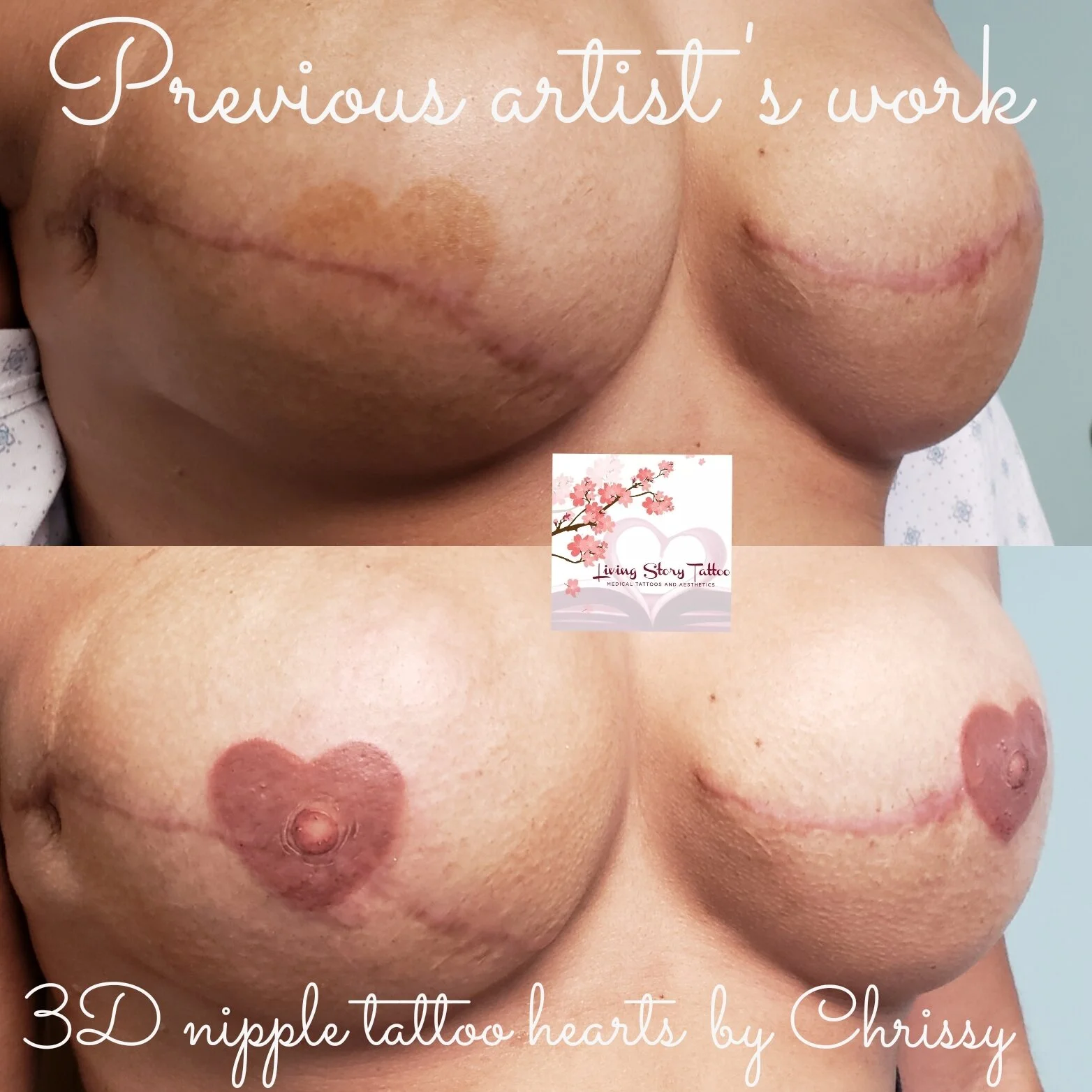 Corrective Heart tattoos