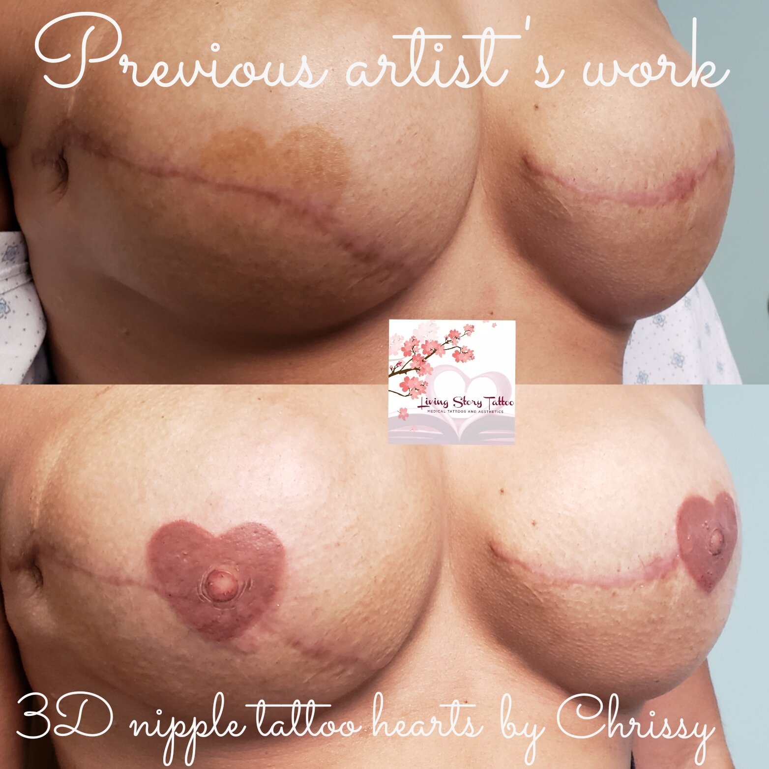 Corrective Heart tattoos