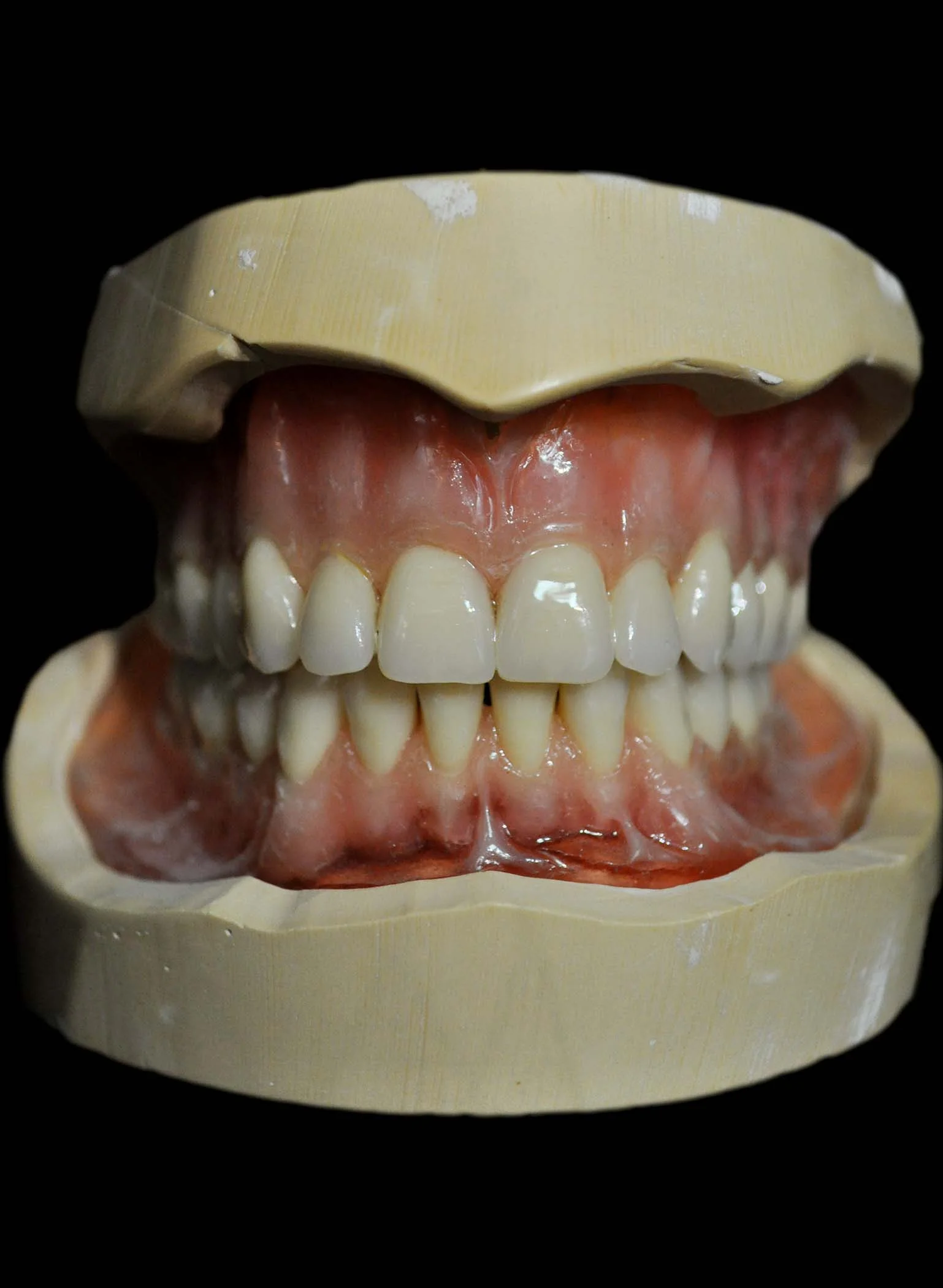 denture.jpg