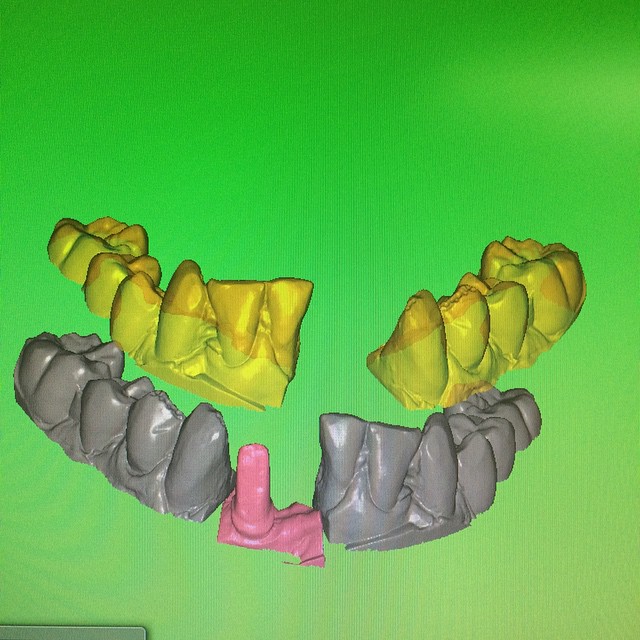 Mirroring lower jaw