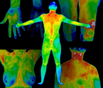 Infared_Scan_Entire_Body.jpg
