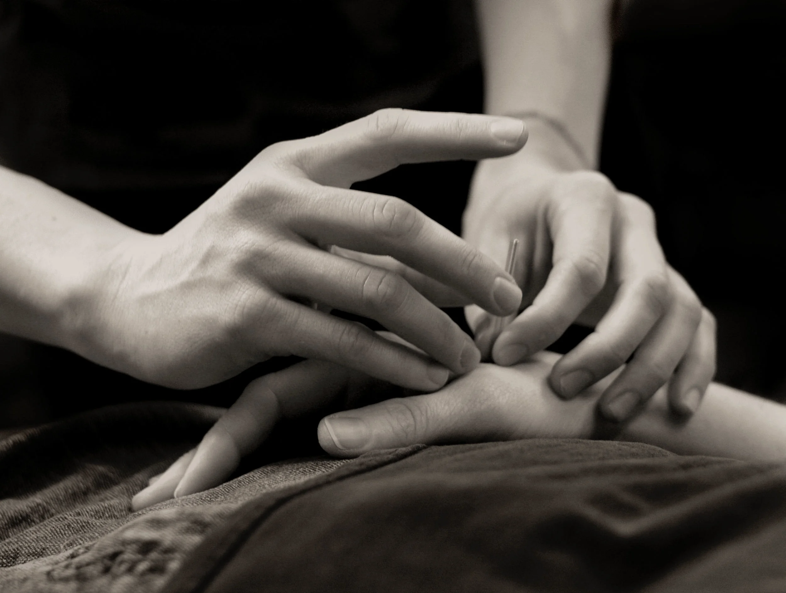 BW_Acupuncture.jpg