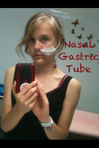 Bethany Gastro Tube.png