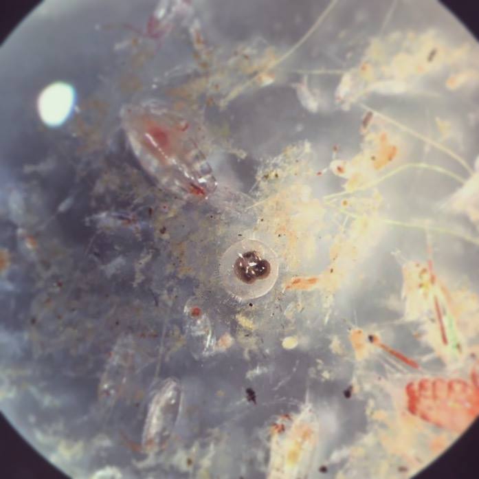 Orbulina universa