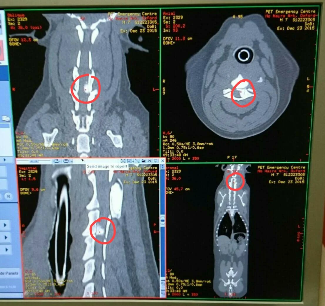 Oxford's CT scans - we have circled the problematic herniation.