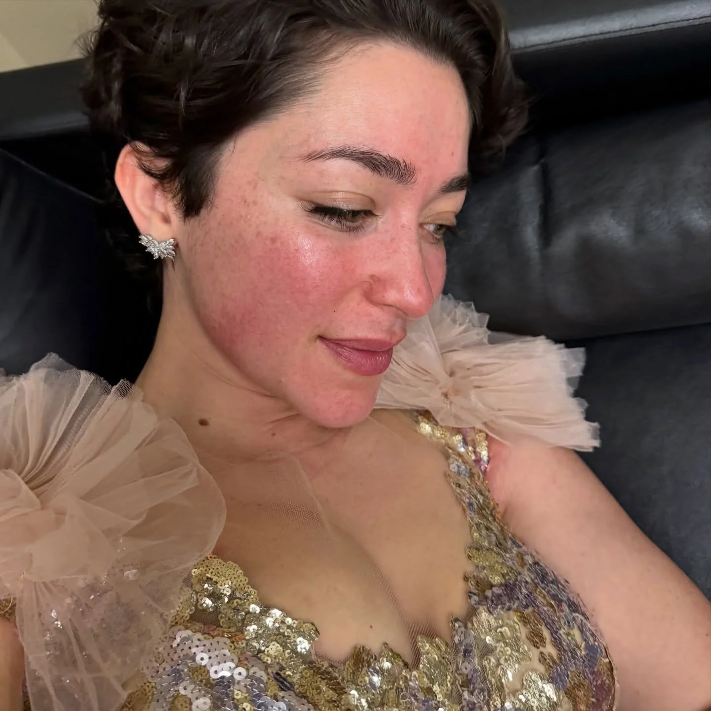 I no longer cover my rosacea and I&rsquo;ve never been happier 💗
my love says my skin looks like a galaxy🤞