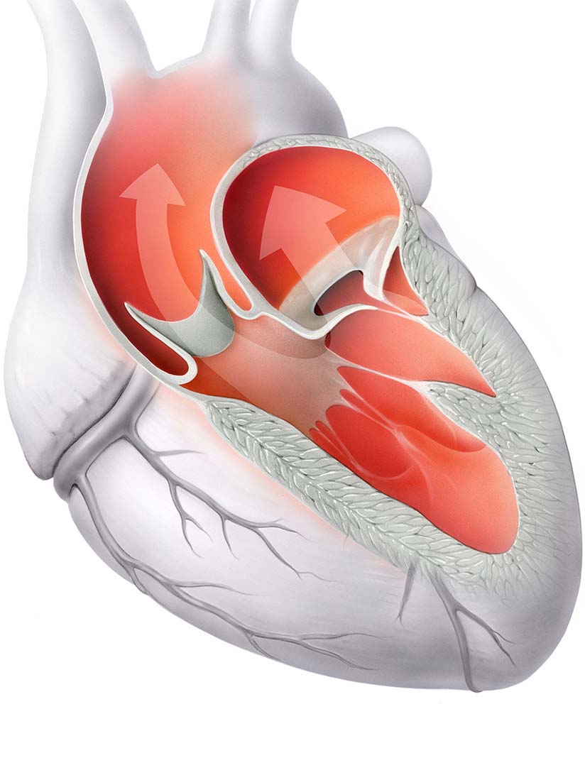 Pump function of healthy heart valves (aortic and mitral valves).