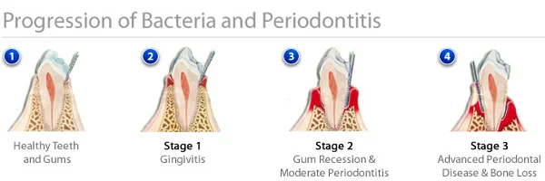 Haber Periodontics & Dental Implants