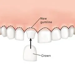 Haber Periodontics & Dental Implants