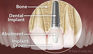 Haber Periodontics & Dental Implants