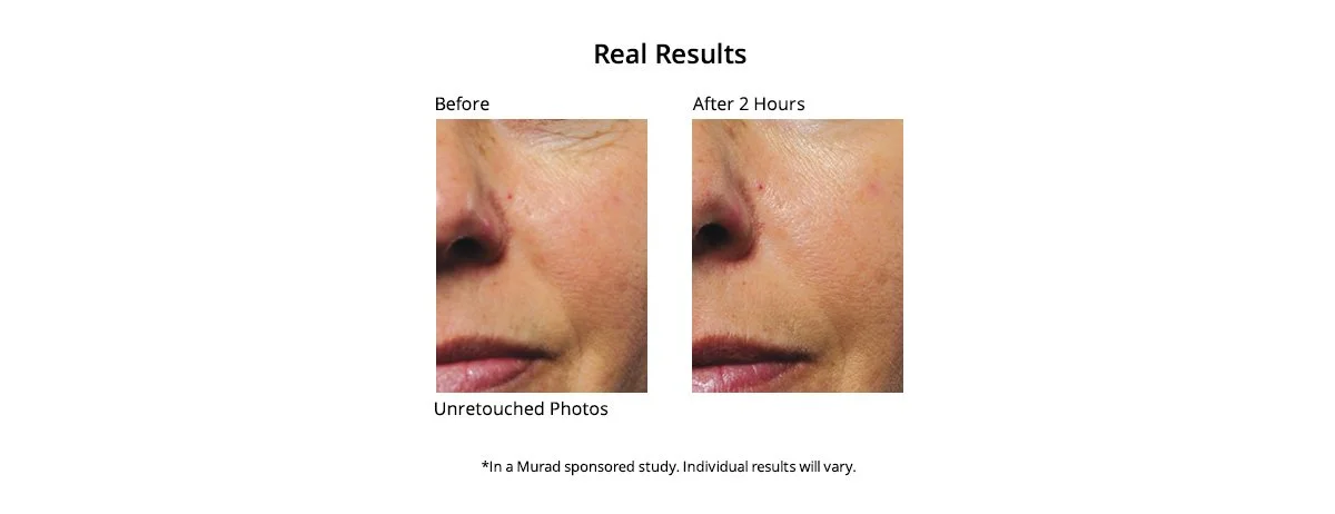 xresults-rci.jpg.pagespeed.ic.1qwR5LVaff.jpg