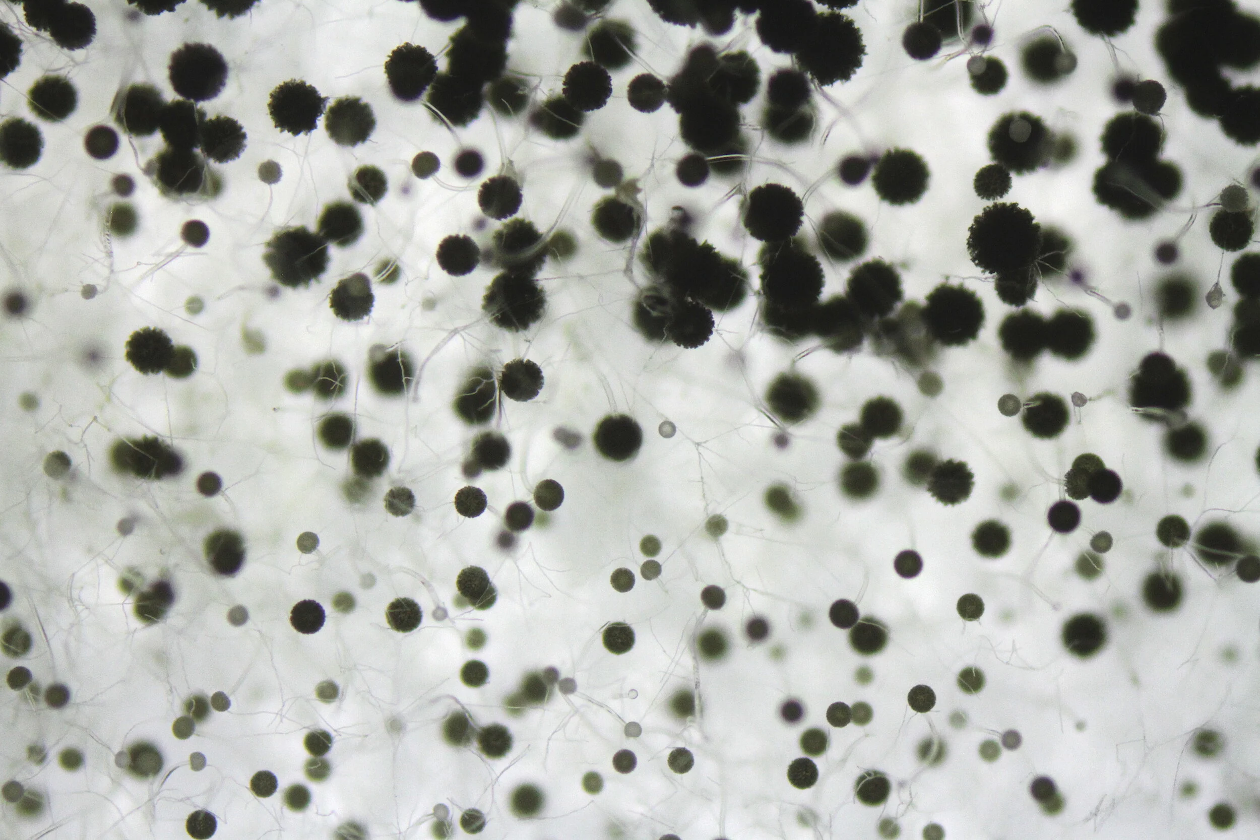  Sporangium of the fungus  Aspergillus niger . Their black color is provided by the pigment melanin.  Image Credit: Sunanda Sharma and Nic Lee 
