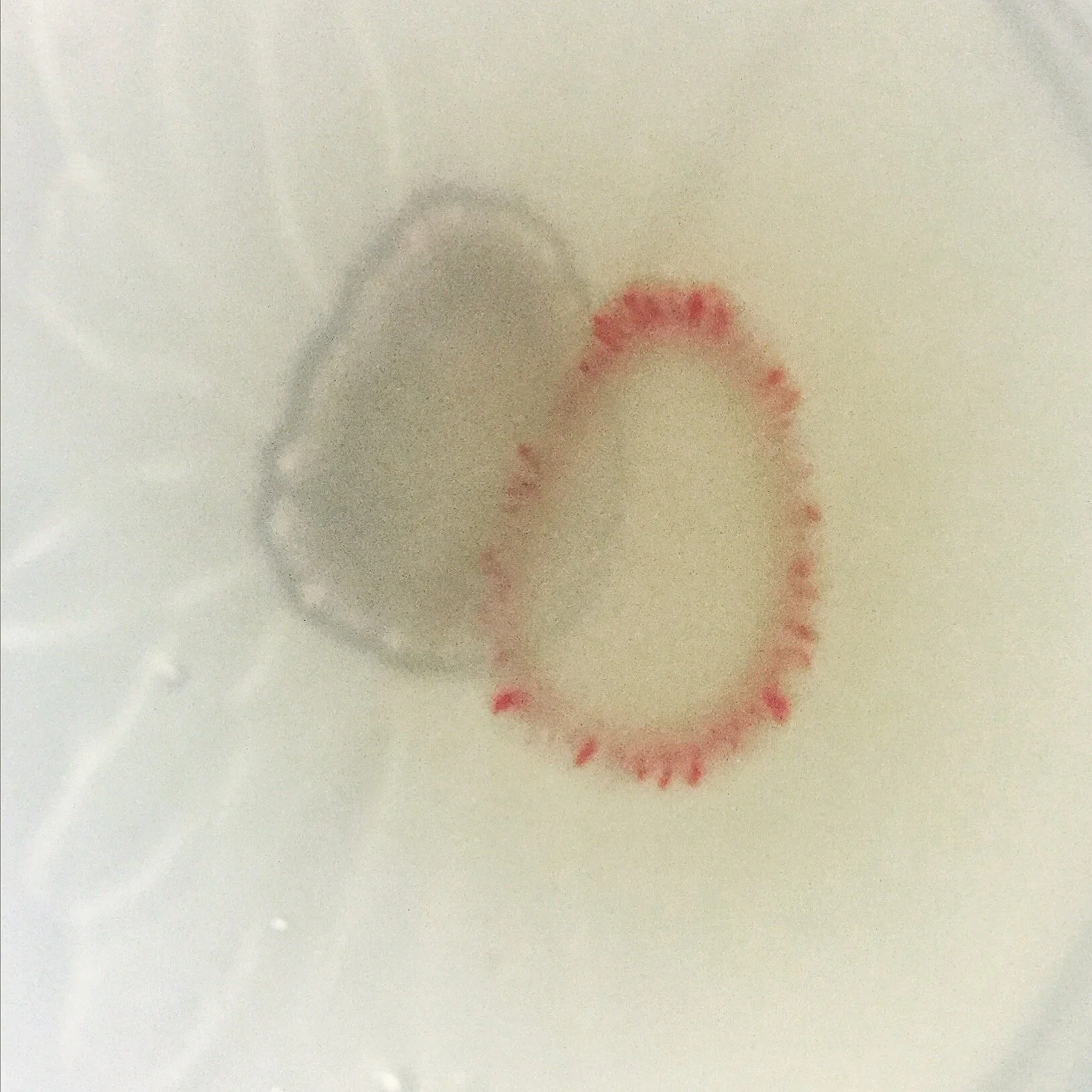 serratia1_iphone.JPG