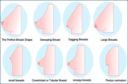 The Perfect Breasts — Breast Augmentation