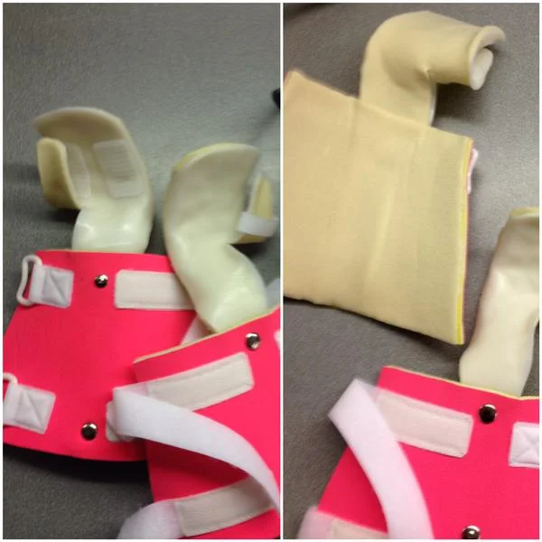splint.jpg