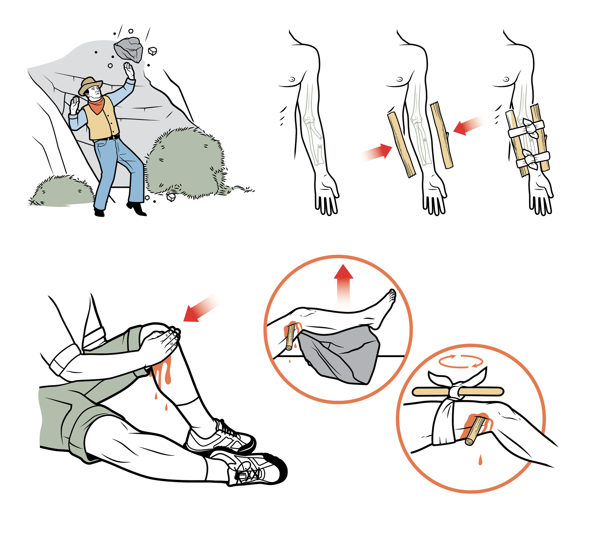 SS_TMD_JW_Splint.png