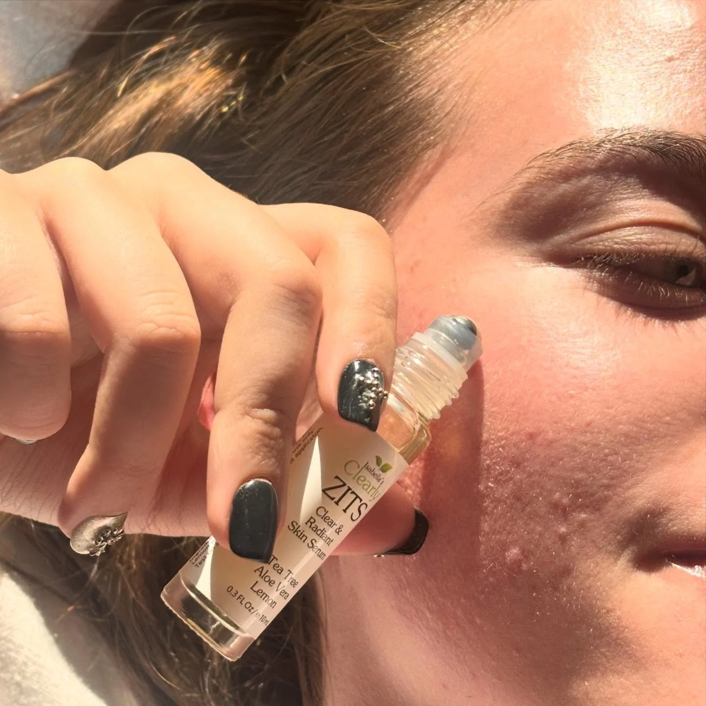 ZITS: Clear &amp; Radiant Skin Serum

+ Helps combat acne while being gentle enough to preserve your skin&rsquo;s natural moisture, preventing dryness
+ With Tea Tree, Aloe Vera, and Lemon