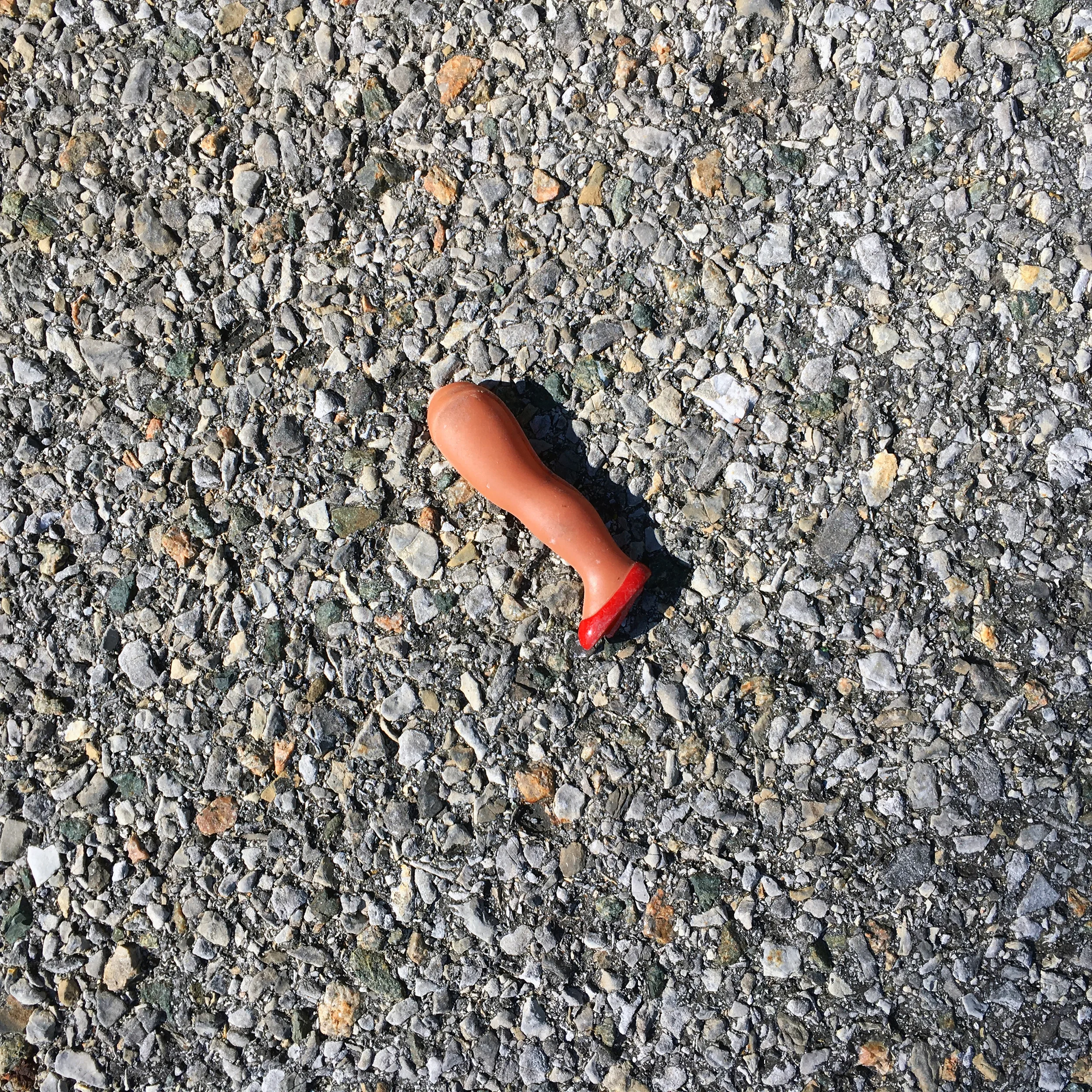 A broken leg.