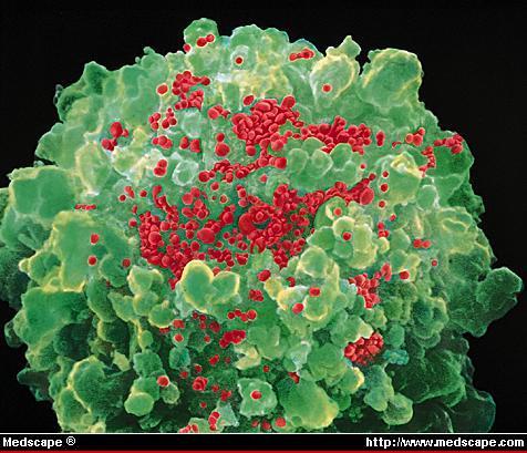 aids-virus_0.jpg