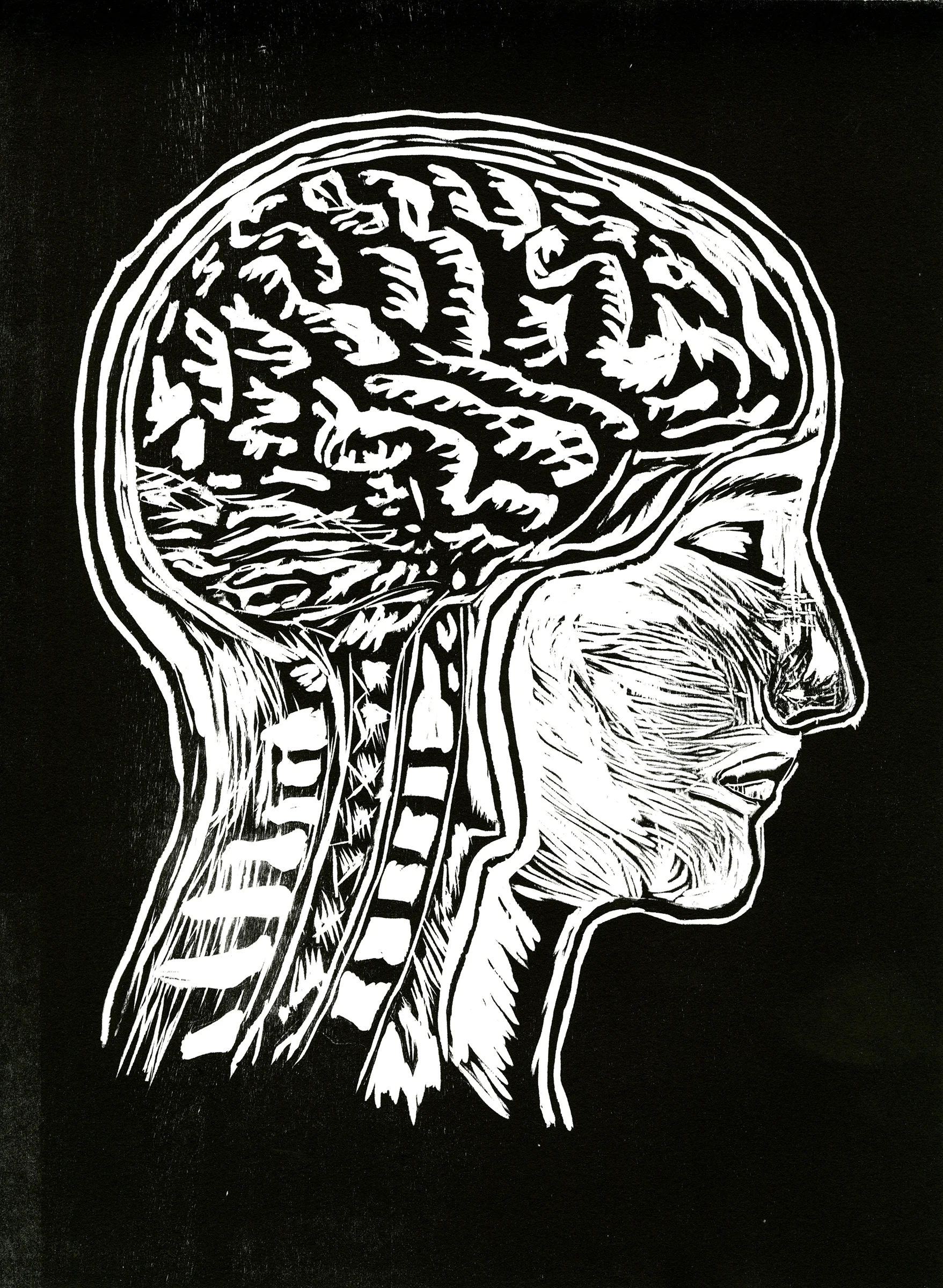 Weathered Brain