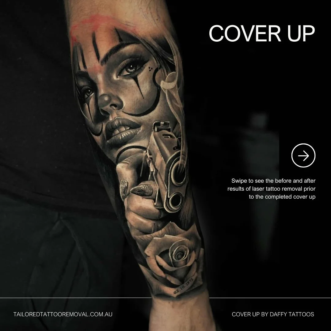 This is what happens when laser tattoo removal and a killer artist team up!👇🏼

First we lighten the tattoo. Then it&rsquo;s time for a new cover up which is next level 🔥

Big shoutout to @daffytattoos from regret to masterpiece! 👏🏼

Swipe to see