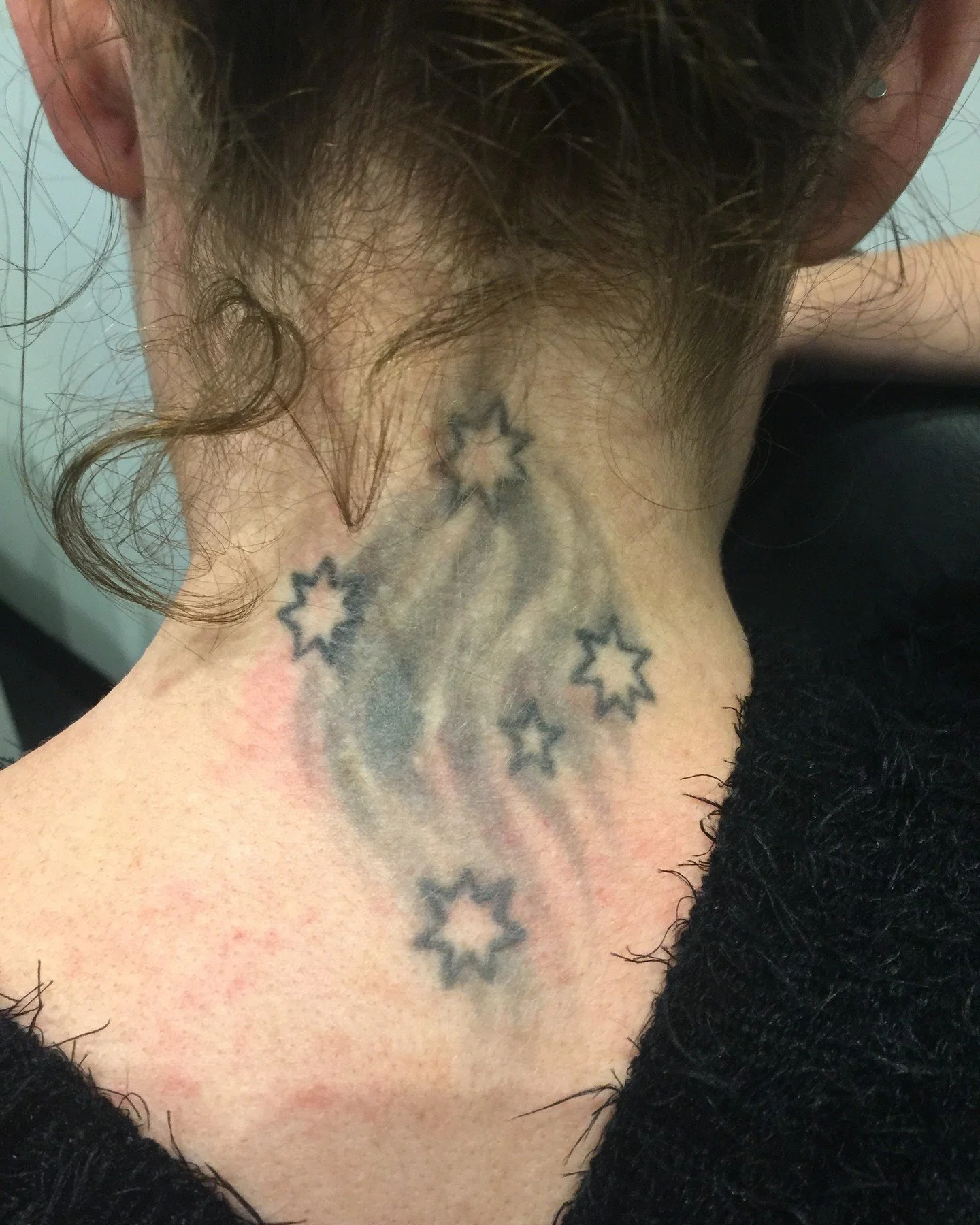 Just in case you were wondering what the process of full removal looks like 👀

Swipe through:
 1️⃣ Before treatment
 2️⃣ After 2 sessions
 3️⃣ After 4 sessions
 4️⃣ After 6 sessions
 5️⃣ After 8 sessions

This is what real, progressive fading looks 