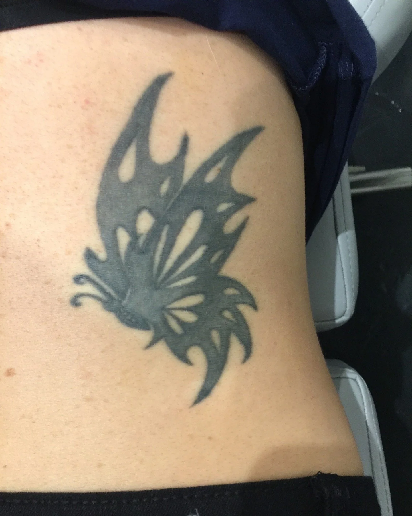 Come along for Laura&rsquo;s journey ✨

Swipe through:
 1️⃣ Before treatment
 2️⃣ After 1 session
 3️⃣ After 5 sessions
 4️⃣ After 8 sessions
 5️⃣ After 11 sessions

This is what real tattoo removal progress looks like, gradual, consistent and done p