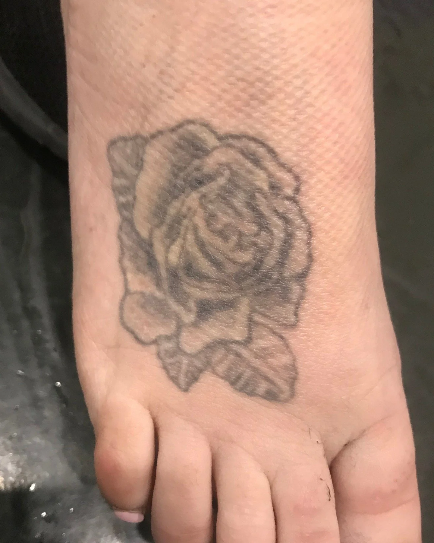 Come along Brooke&rsquo;s journey with us ✨

Swipe through:
 1️⃣ Before treatment
 2️⃣ After 2 sessions
 3️⃣ After 4 sessions
 4️⃣ After 6 sessions

This is what realistic tattoo removal looks like.
Not instant. Not overnight.

Just consistent progre