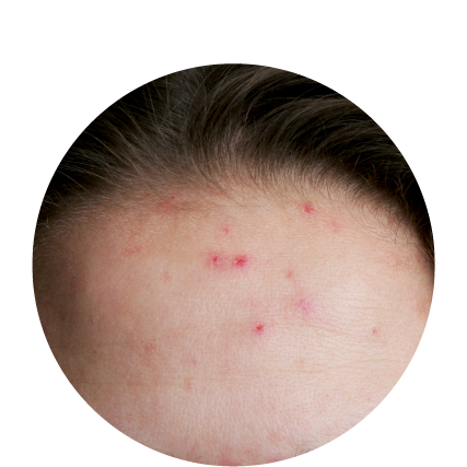 BENEFITS-03.png