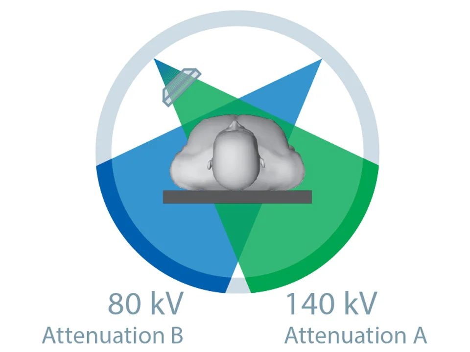Siemens Dual Source CT Scanner