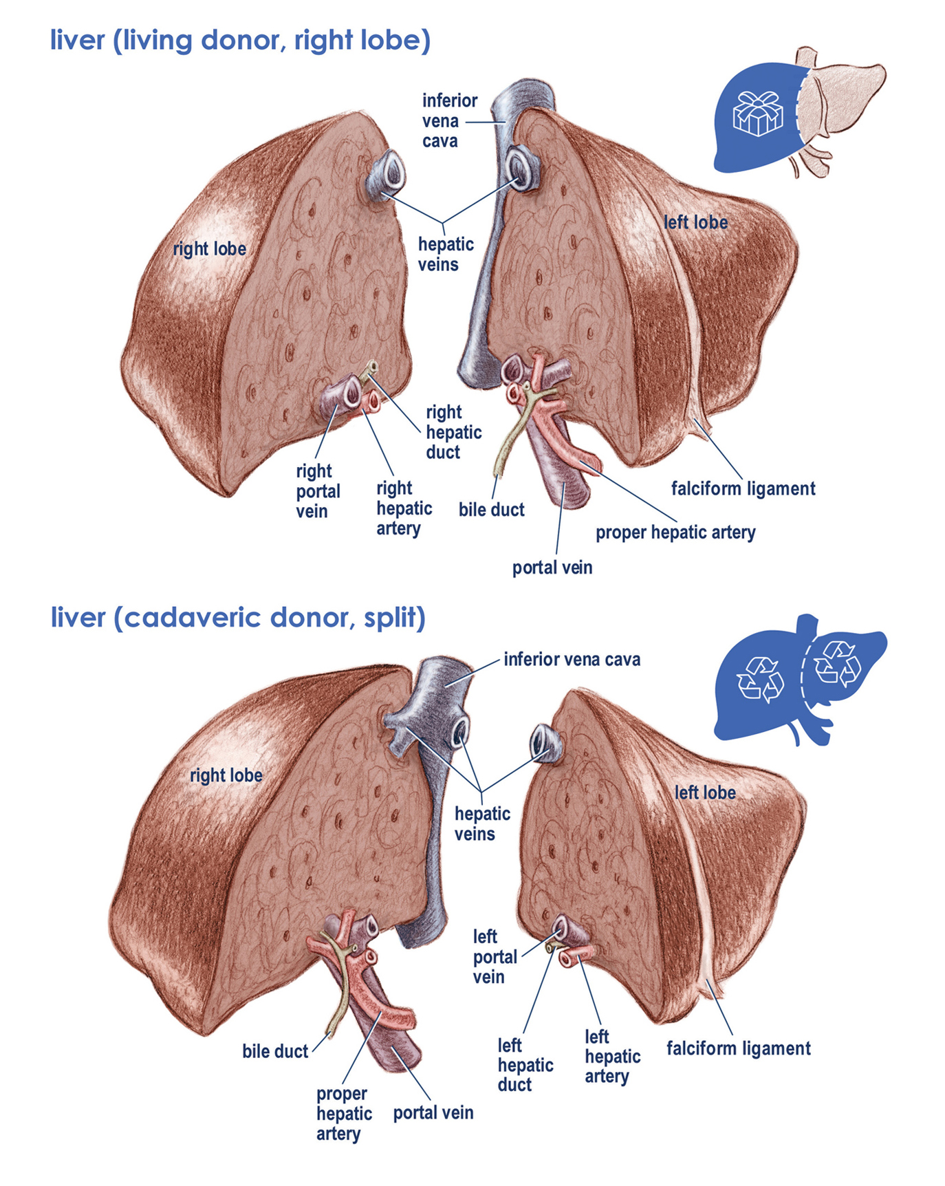 Liver Transplantation Surgery
