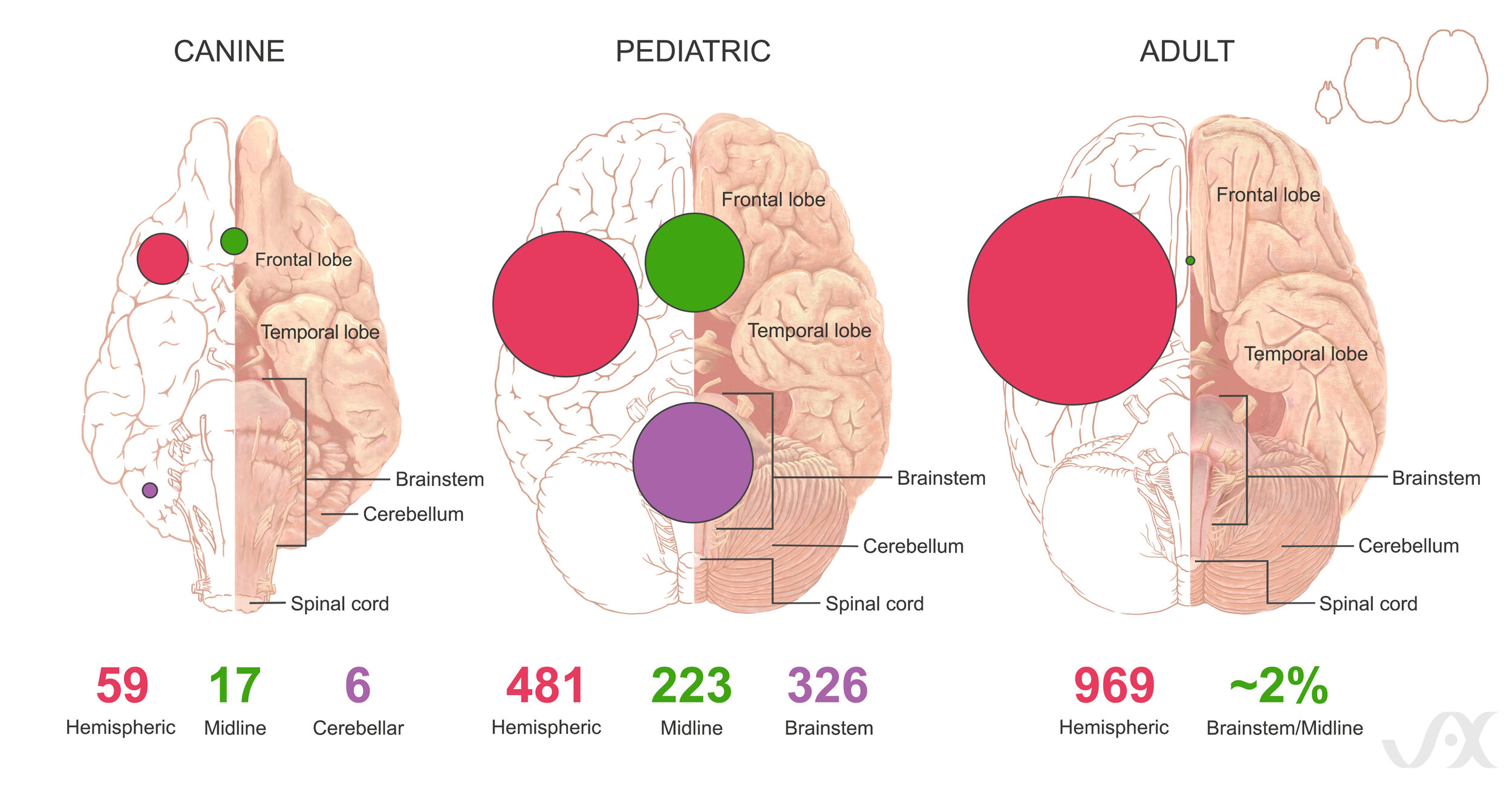 Glioma Research illustration, journal article