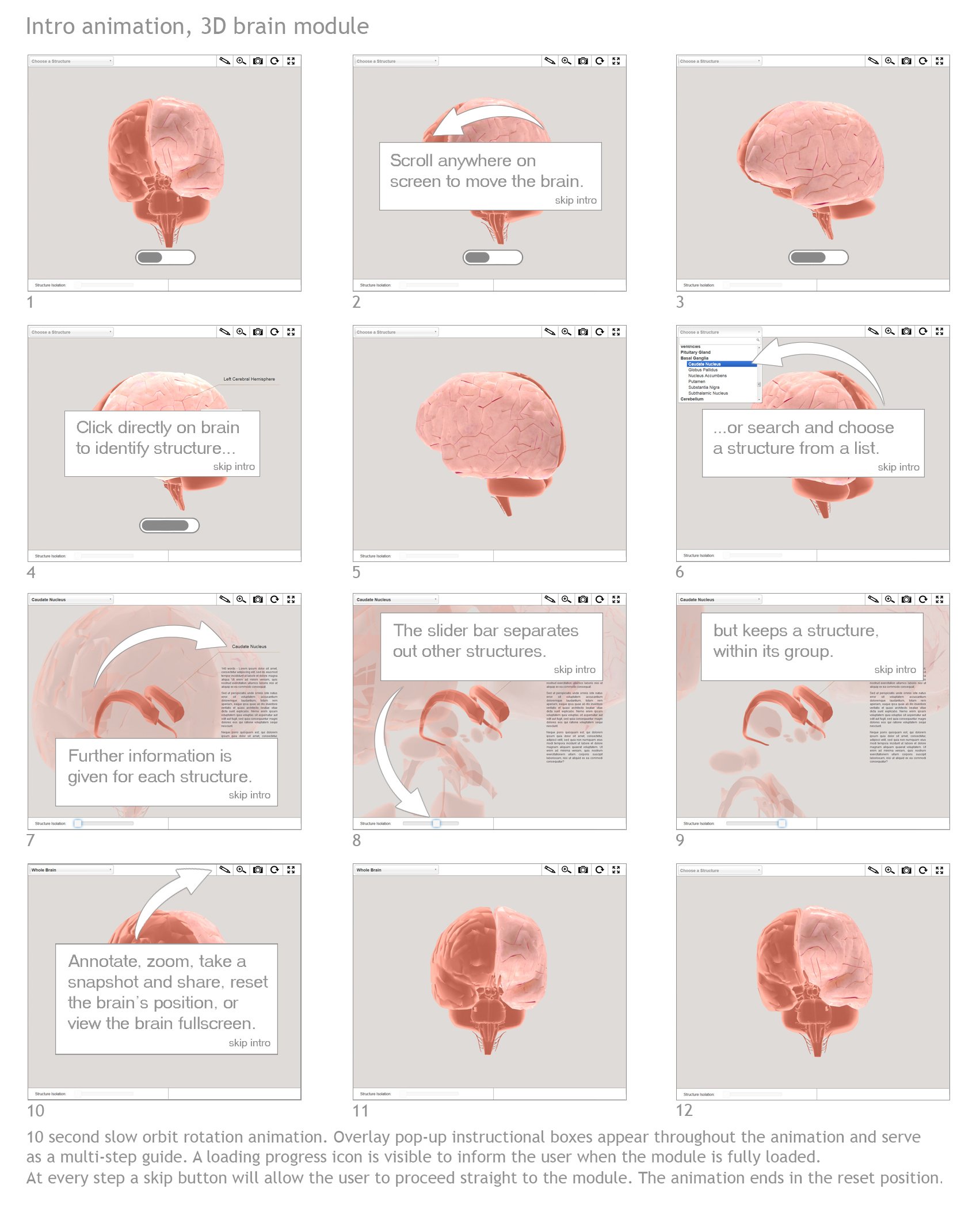 3D Brain project storyboard