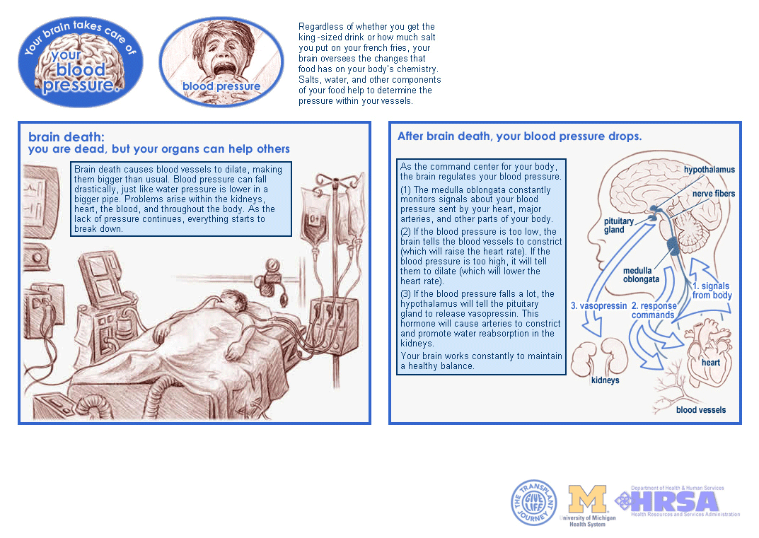 Brain death interactive pages