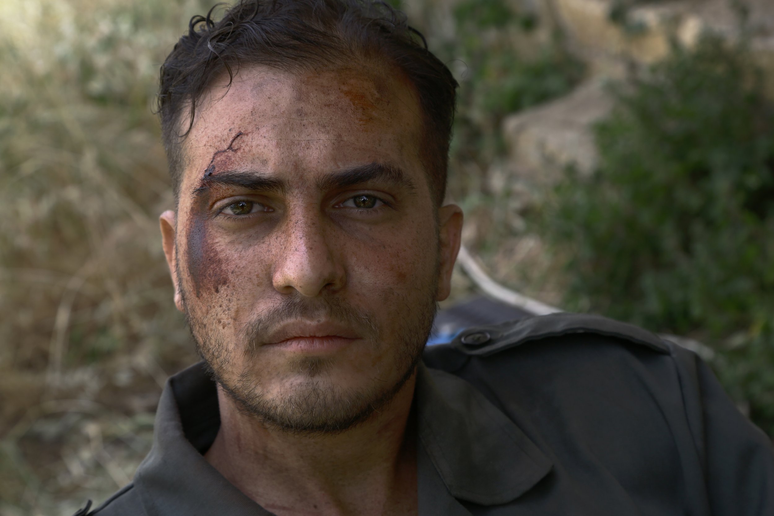 rony_yucef_youssef_sfx_artistic_silicon_prosthetics_makeup_artist_Photography_actor_editorial_dubai_kuwait_lebanon_uae_ksa_spain_uk_la_bodyart_art_war_film_production_wound_scar_skinartist_soldiers_patina.jpeg