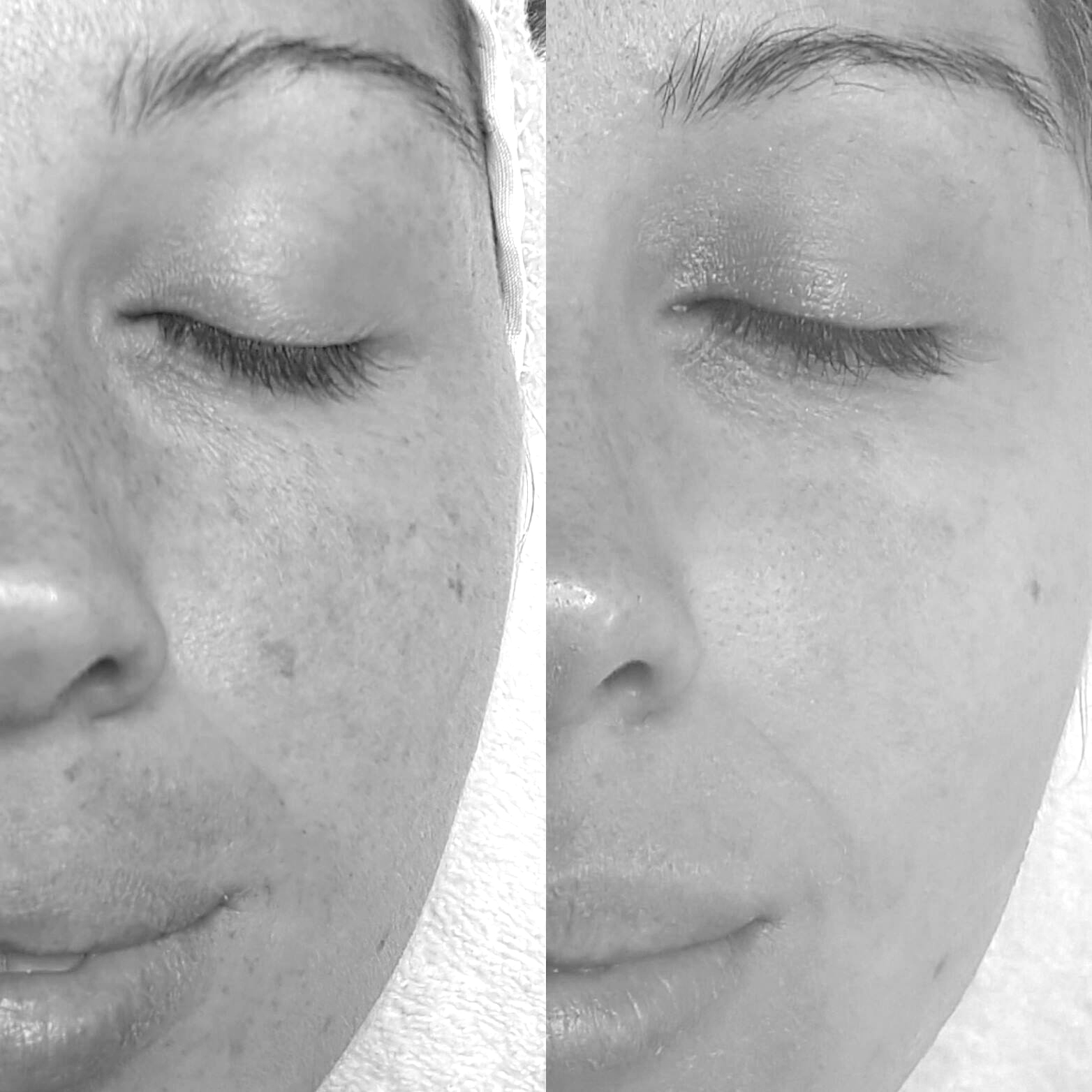 Before & After