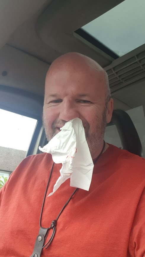 Mick nose bleed.jpeg