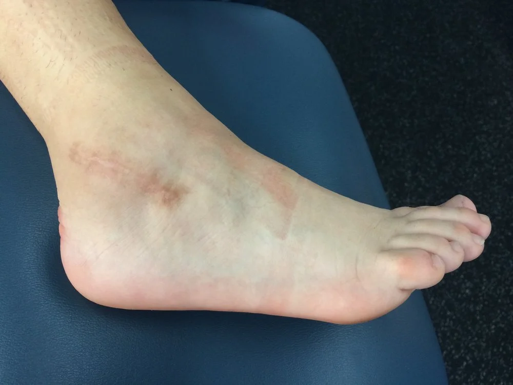 foot_1.jpg