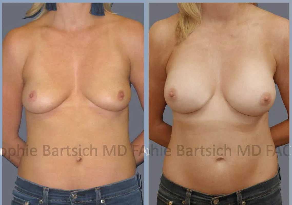 breast desat copy.jpg