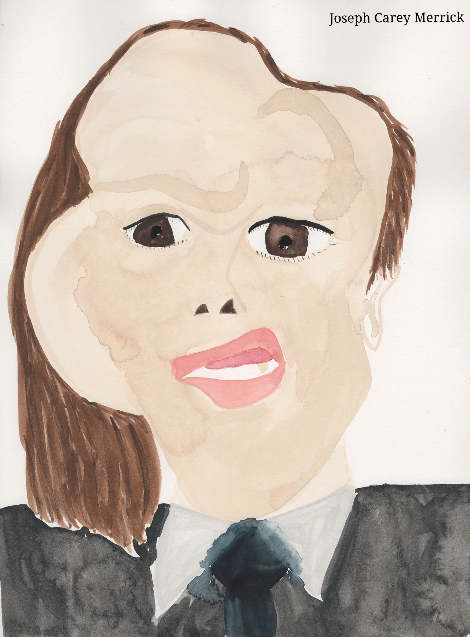 Joseph Carey Merrick:The Elephant Man