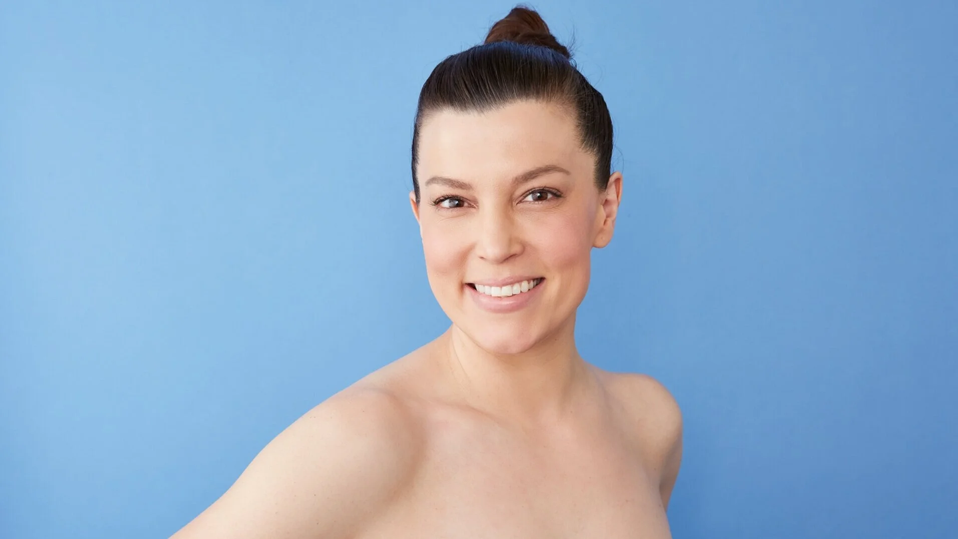 Botox_117.jpg