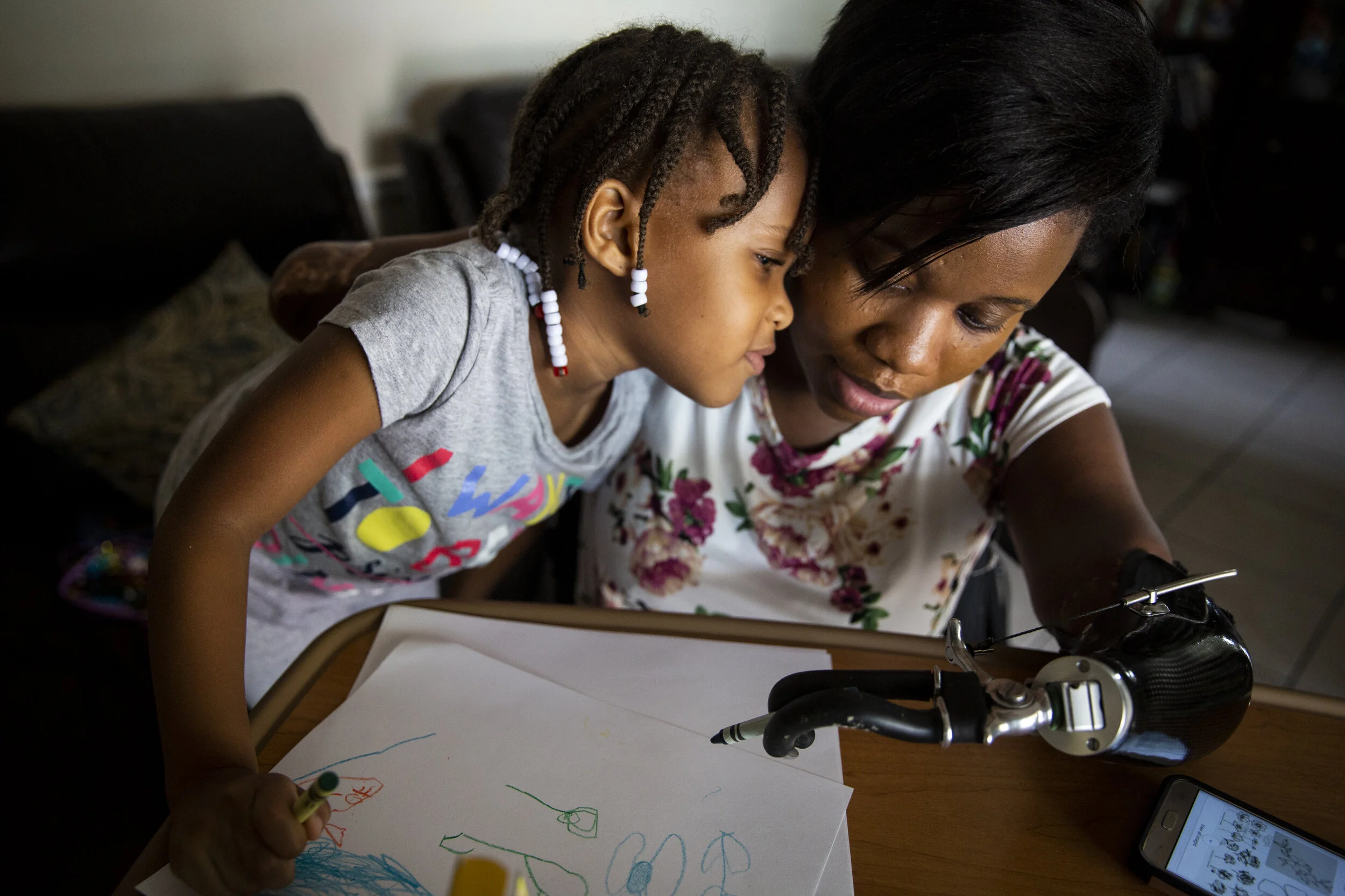  Aaliyah Ferguson-Walker, 4, leans on her mother, Kayleigh Ferguson-Walker, while they draw with crayons at Kayleigh's parents' home in Coral Springs, Florida, on November 17, 2018. In March 2017, Kayleigh contracted sepsis, which caused her to lose 